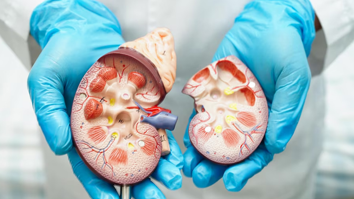 kidney-disease