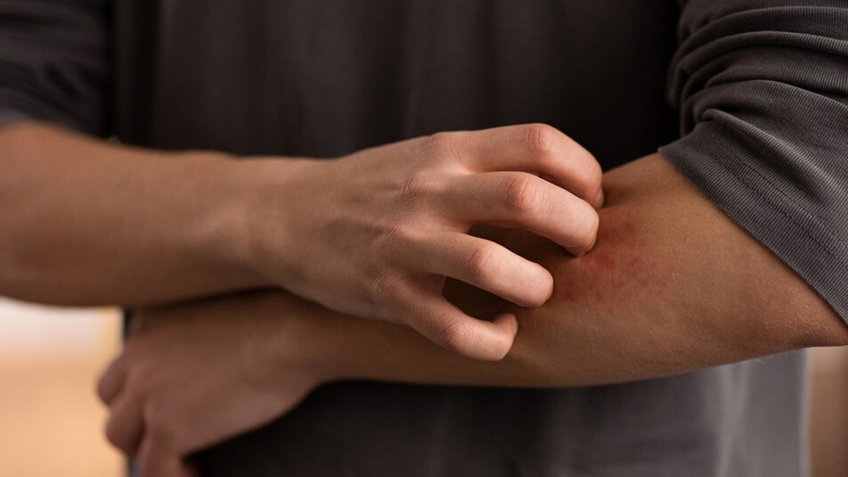 Here Are Some Diseases That May Be Causing Persistent Skin Rashes