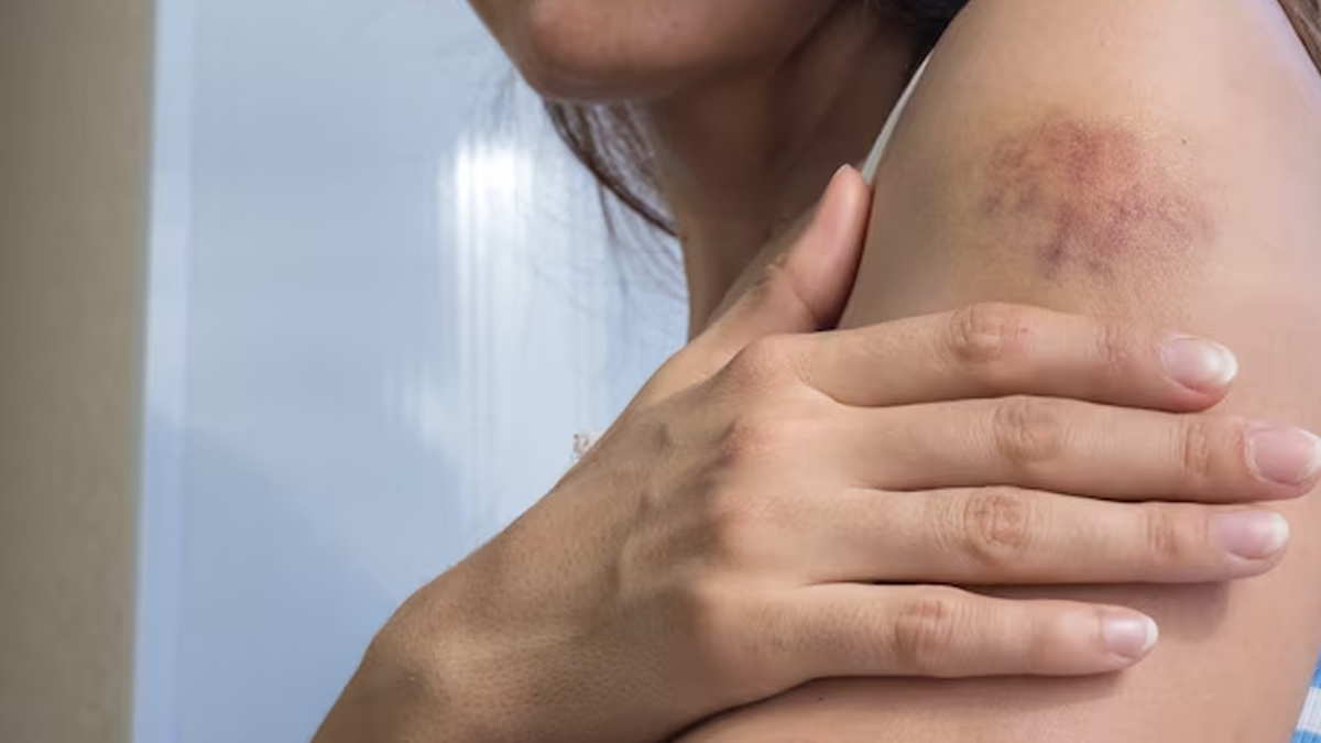 Here Are Some Diseases That May Be Causing Persistent Skin Rashes