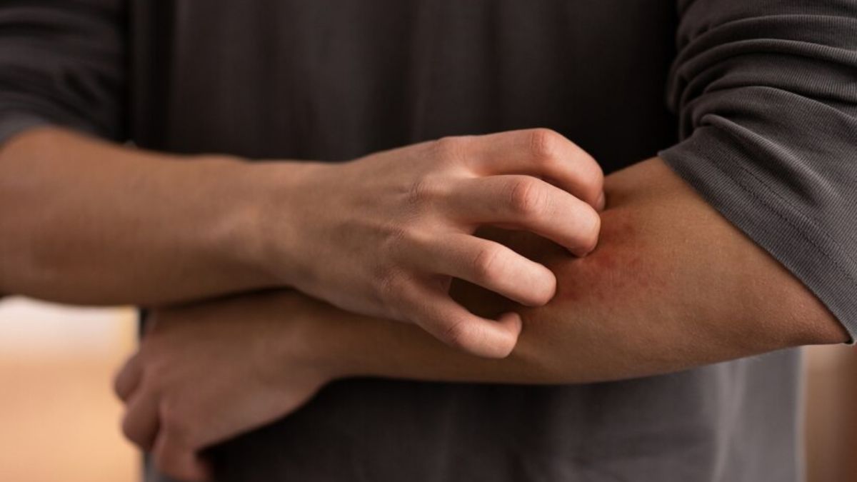 Can Men Get Fungal Infection