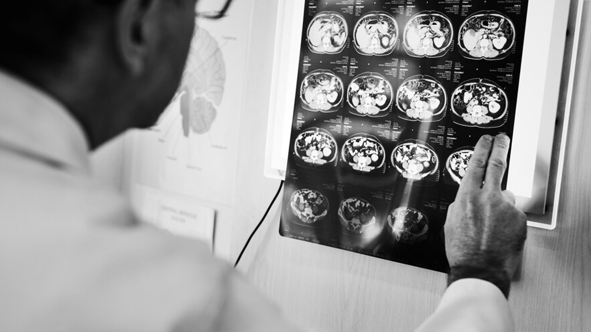 Expert Discusses Long-Term Effects Of Head Trauma And Risk Of Brain Injury To Relapse
