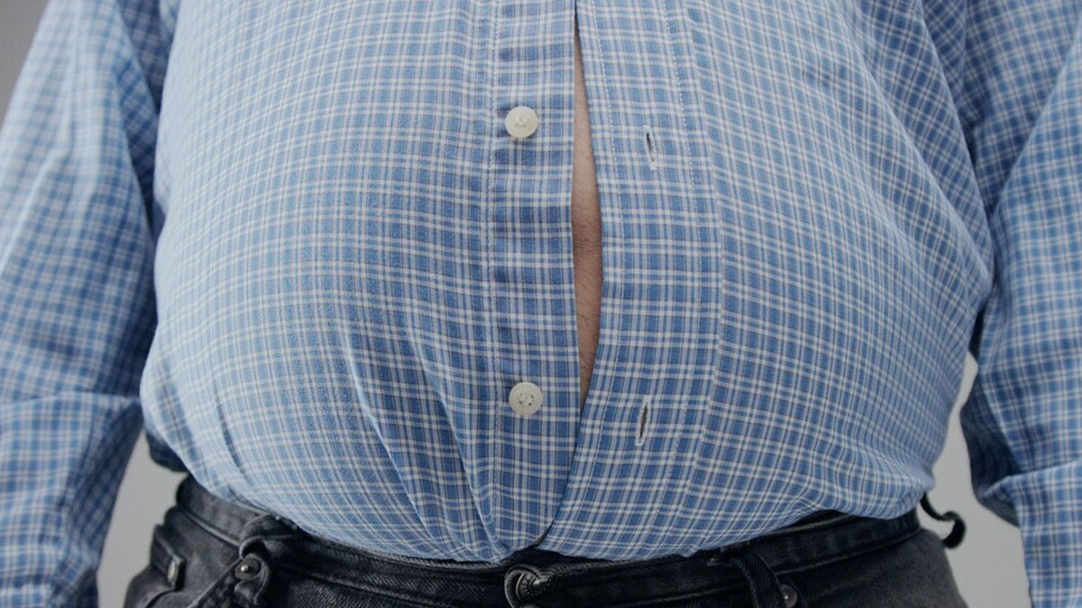 obesity