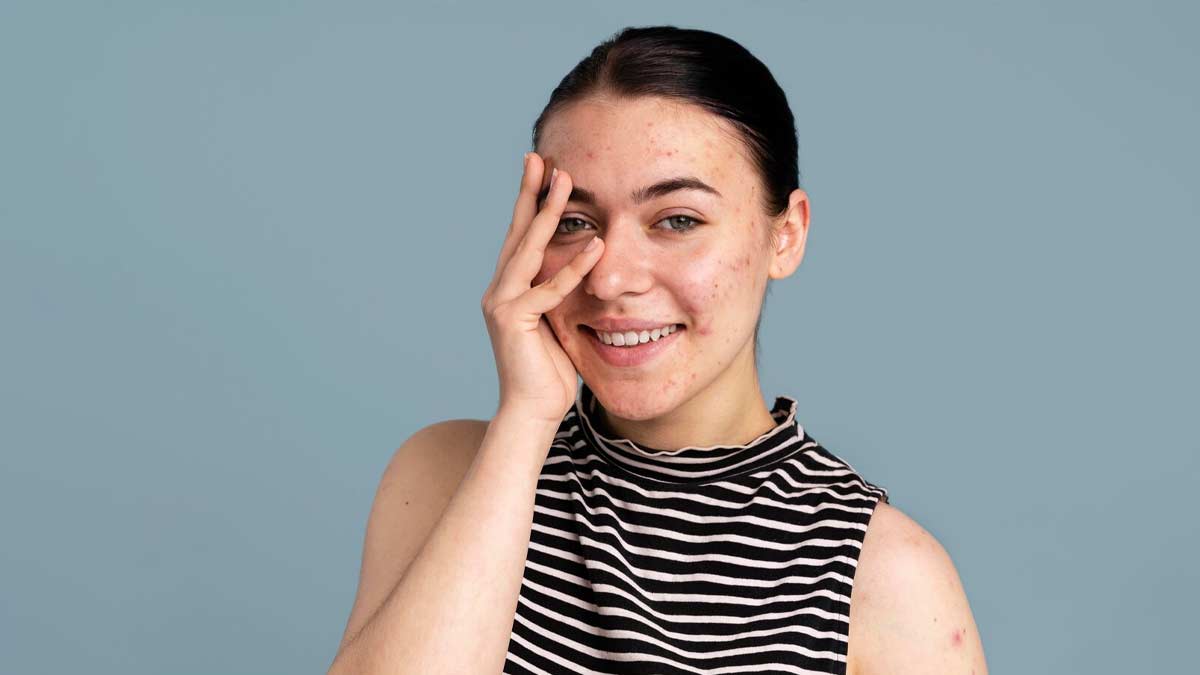 side-effects-of-using-ice-on-face-