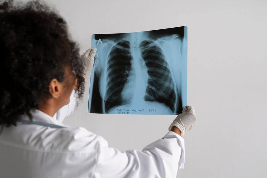 chest-xray