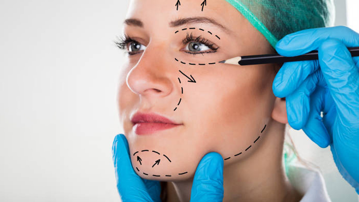 Face lift