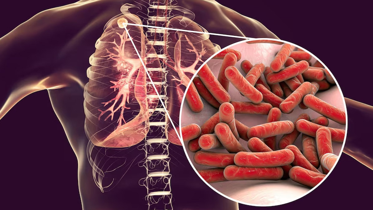 The Most Common Types of Respiratory Diseases