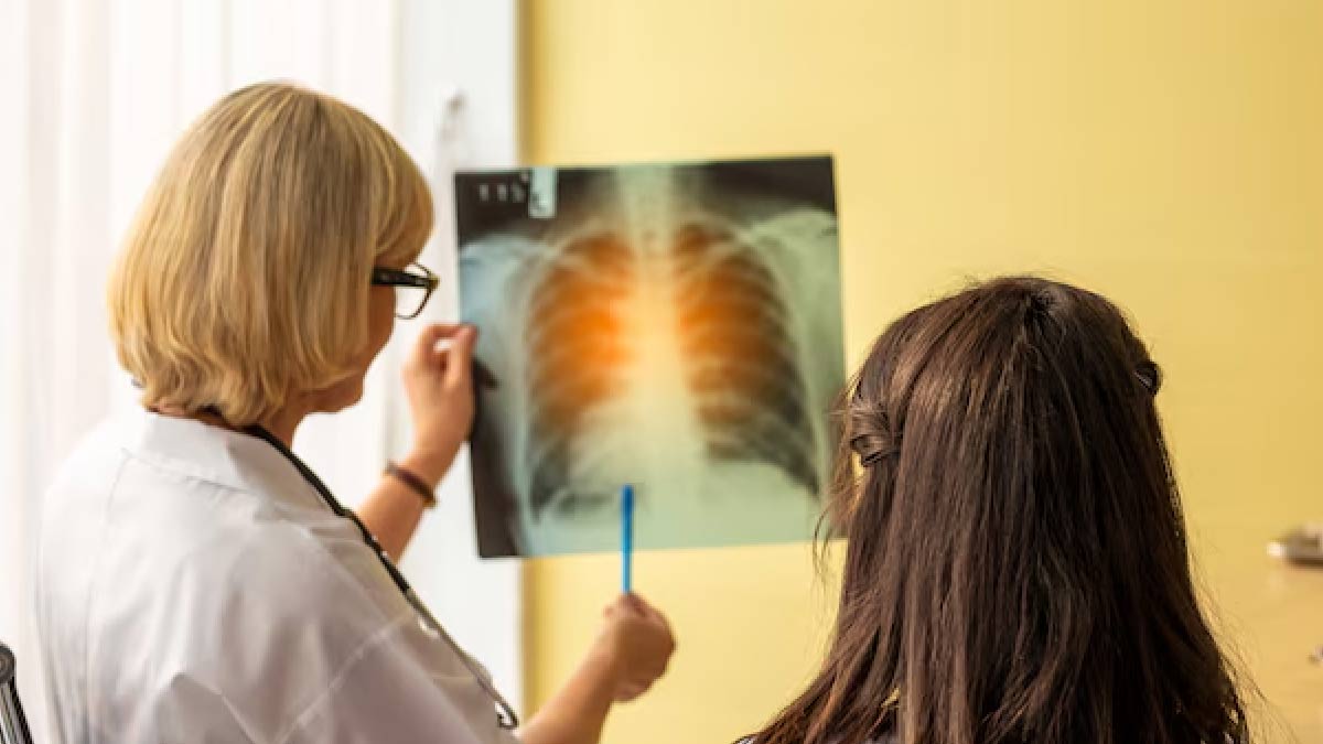 How Interstitial Lung Disease Is Treated