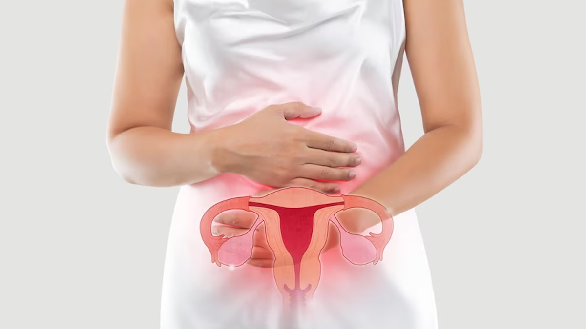 What Is Uterine Tuberculosis? Symptoms, Risk Factors, Treatment