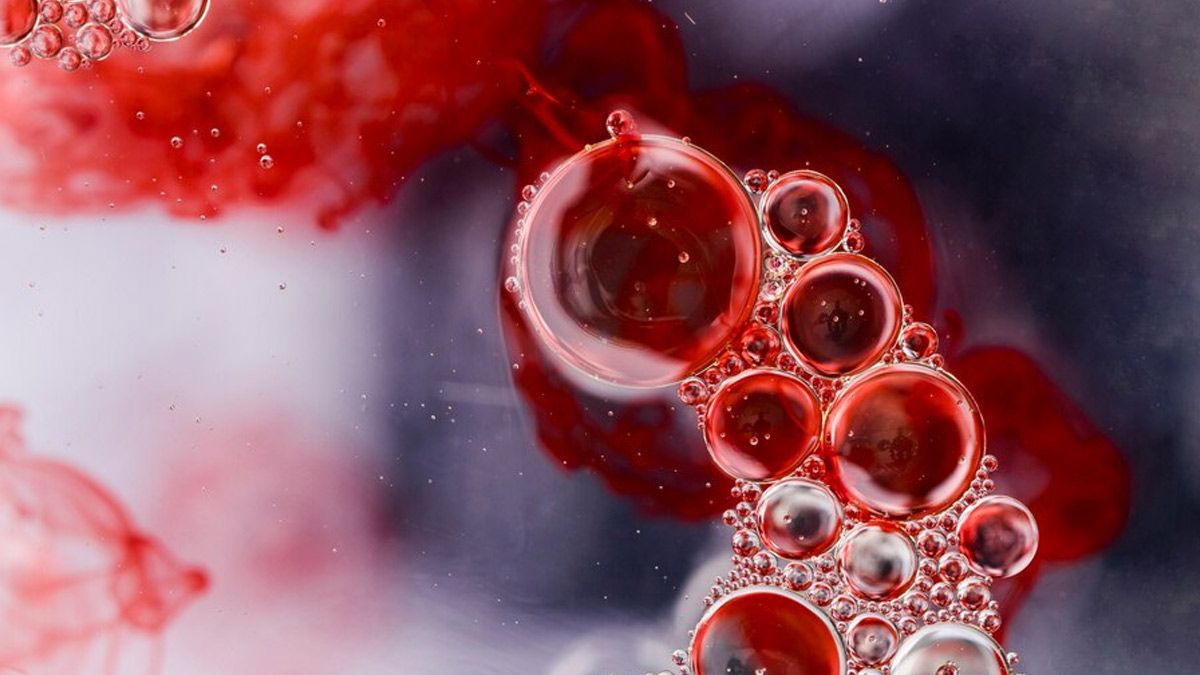 What is Haemophilia A? Causes, Signs, Treatment