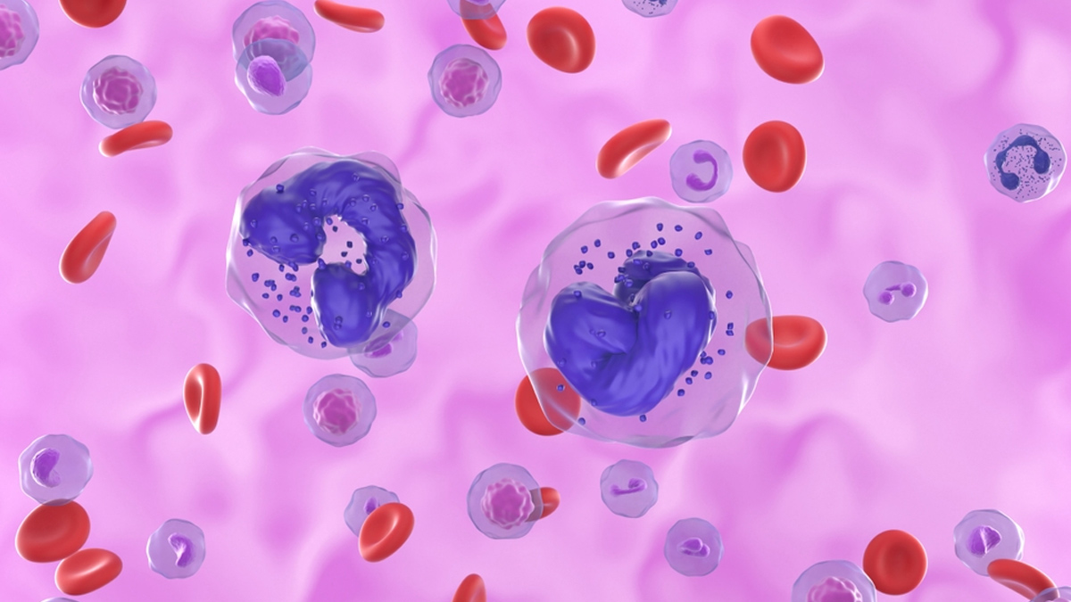 chronic-myeloid-leukemia