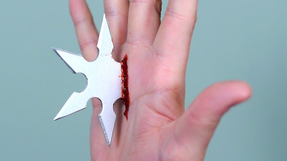 mirror wound first aid treatment