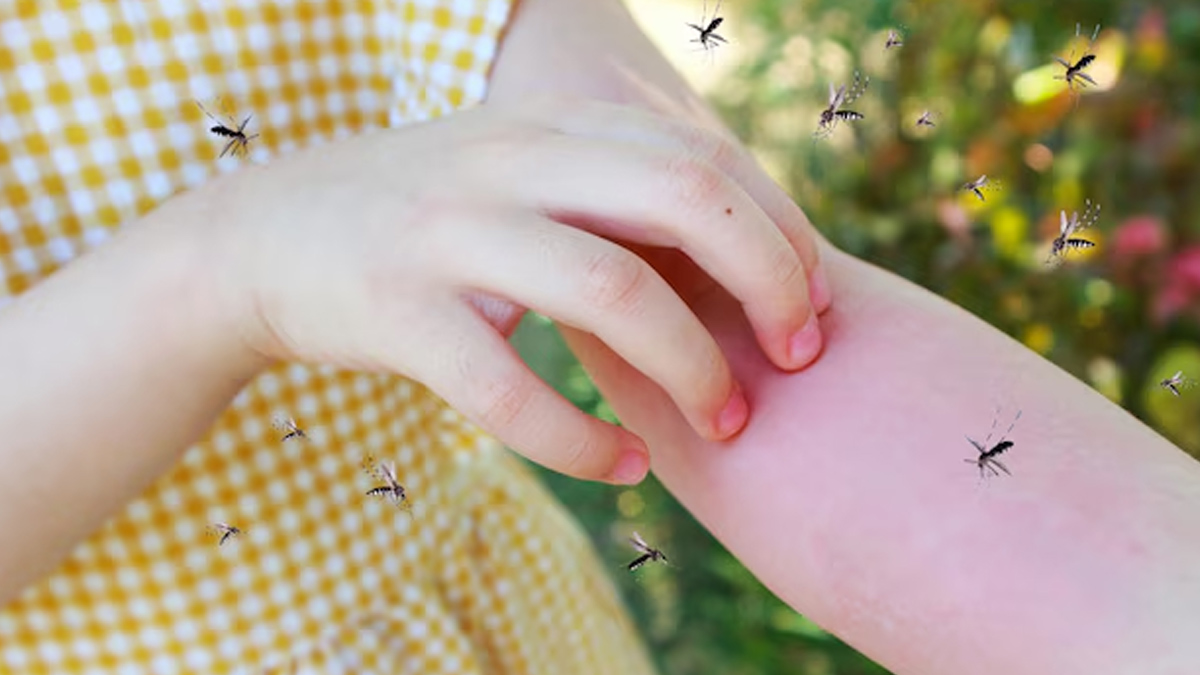 Bug-Bite-vs-Mosquito-Bite-inside