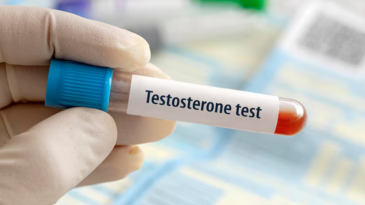 Testosterone therapy