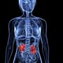Learn About Chronic Kidney Disease
