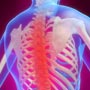 How Many Types of Bone Cancer are there?