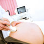How to Choose an OBGYN (Obstetrician Gynaecologist)