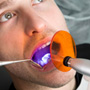 Benefits of Laser Teeth Whitening