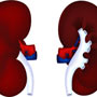 5 stages of chronic kidney disease