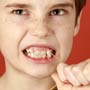 Is it Necessary to Remove Wisdom Teeth?