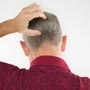 What are the Risk Factors for Head Lice?