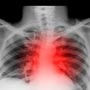 What are the Types of Lung Diseases?