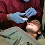 Tooth Darkening after Root Canal