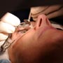 Should You Opt For Laser Eye Surgery?