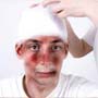 Brain Injuries and PTSD Risk