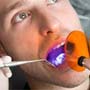 Sealing Out Tooth Decay