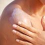 Keep yourself away from sunburn with Ayurveda