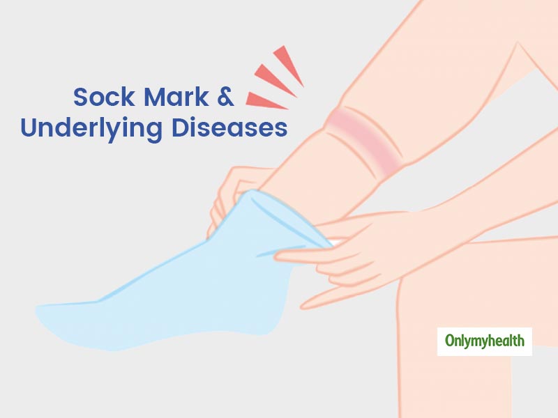 4 HEALTH BENEFITS TO WEARING SOCKS