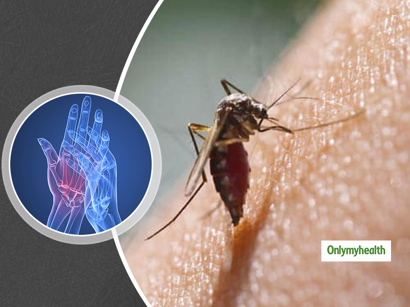Chikungunya and Rheumatoid Arthritis Are Different. Here Are Some Common Symptoms That Cause Confusion