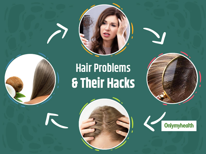 How to stop hair fall and Ways to Prevent Hair Loss with Home Remedies