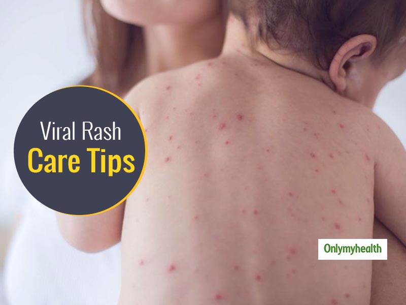 Tips To Identify and Diagnose A Viral Rash in Infants