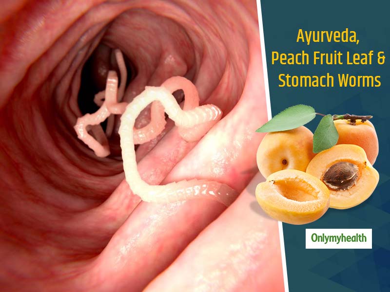 Peach Fruit Leaf For Stomach Worms: Know How To Treat Intestinal Worms As  Told by Baba Ramdev<!-- -->