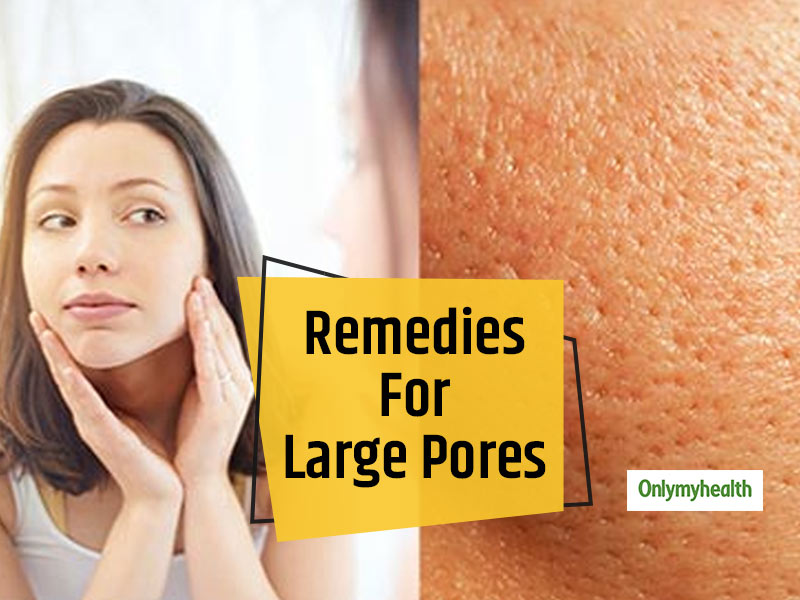 Skincare Home Remedies: Get Rid Of Large Pores On The Face With These Natural Ingredients