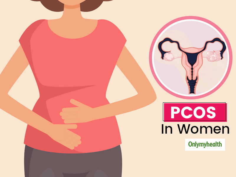 PCOS & Women's Health: Need For Timely Diagnosis In Women, Symptoms, And Treatment To Overcome PCOS