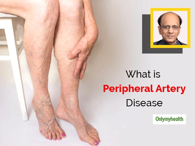 Numbness In Feet Is A Sign Of A Serious Artery Disease, Explains Dr KK Aggarwal