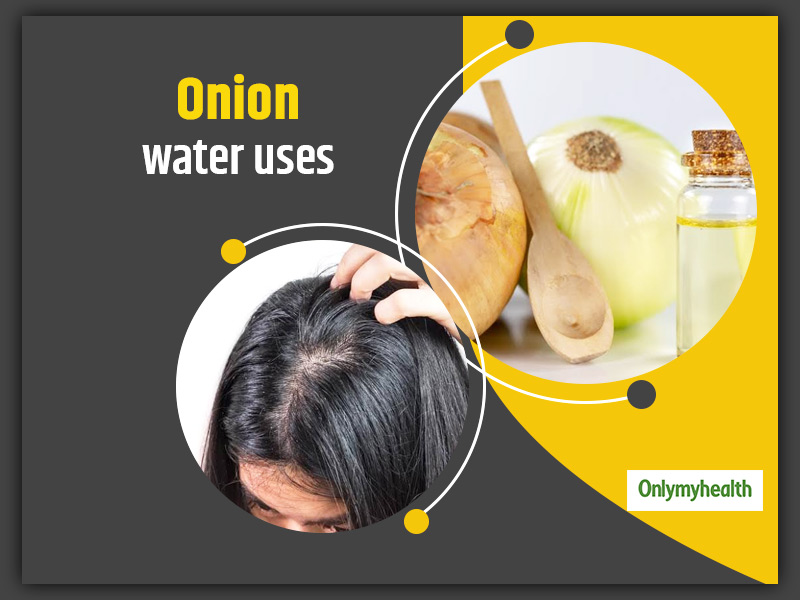 What Are The Uses Of Onion Water? Here's How You Can Make It