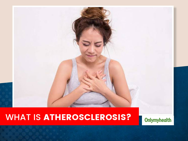 Atherosclerosis: Symptoms, Causes, Treatment And Tips To Prevent by Dr Viveka Kumar