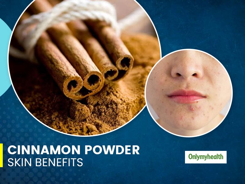 Cinnamon Health Benefits And What Happens If You Take Excess Cinnamon Benefits Health Uses Of Cinnamon Powder