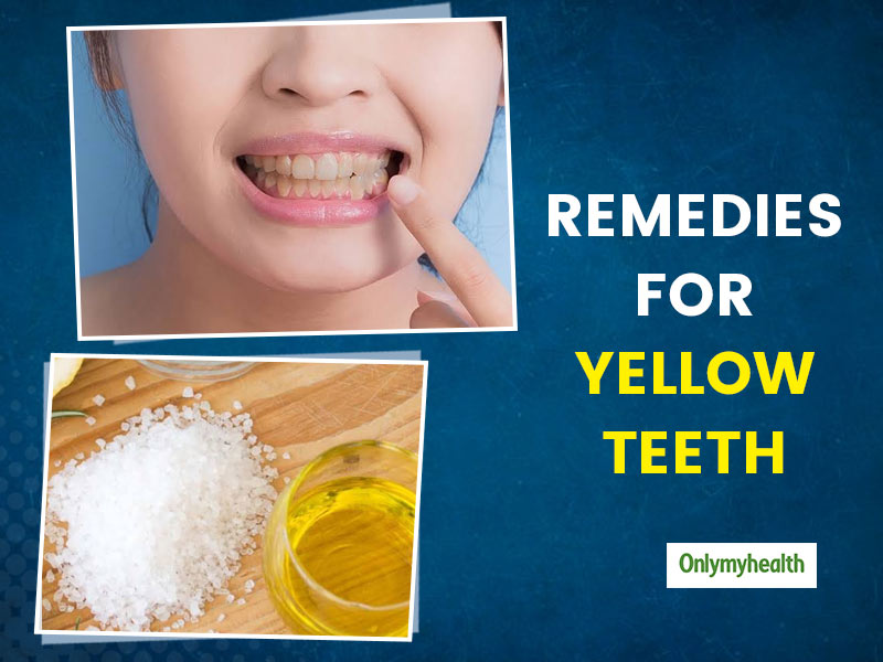 stained teeth home remedy