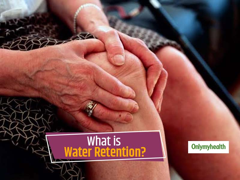 Water Retention: Causes, Symptoms, Treatment And How To Recognise It