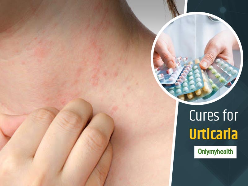 Medanta  Skin Allergy: Symptoms, Causes and Treatment