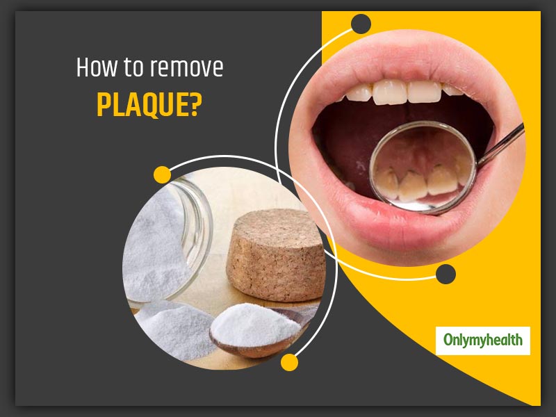 Are You Unable To Smile Freely Due To Tooth Plaque? Know Causes And Home Remedies 