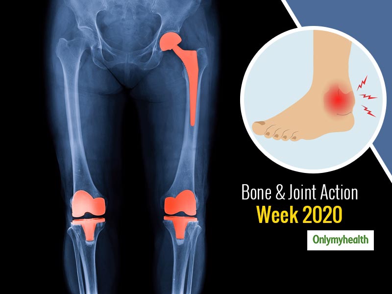 Know-Why Bone And Joint Health Are Necessary For A Good Quality Of Life