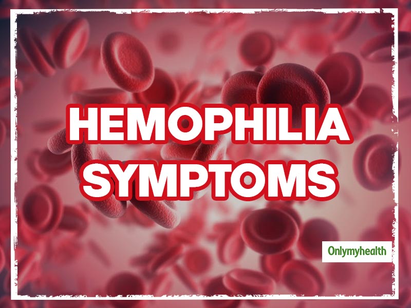 Hemophilia Symptoms: These 3 Conditions Could Be Possible Indicators Of  Hemophilia