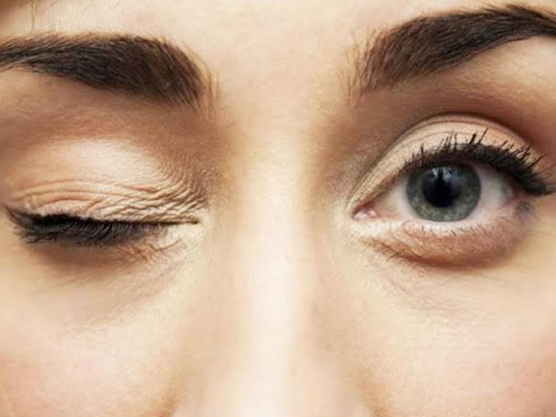 Is Your Eye Twiching? Know The Causes, Treatment And Prevention