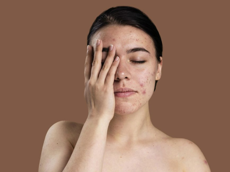 Keep Skin Damage At Bay By Following These 7 Useful Tips 