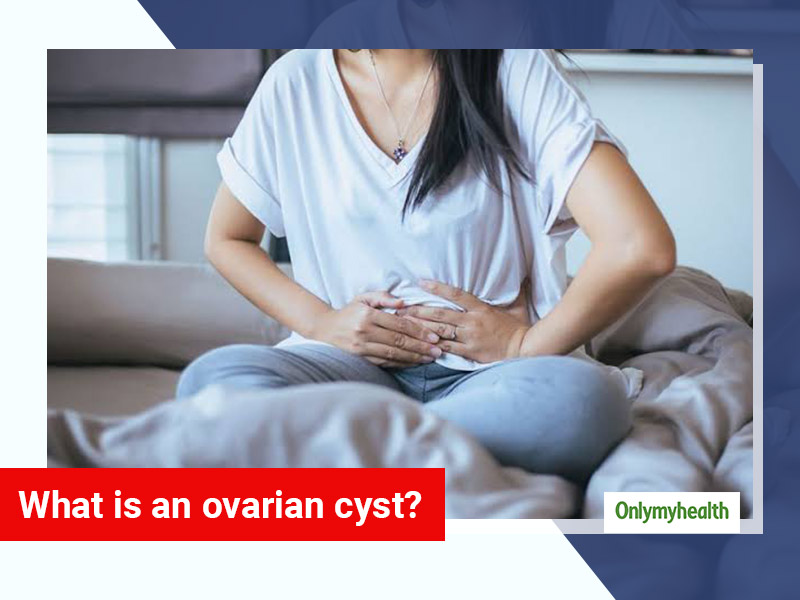 Ovarian Cyst: Know The Types, Causes, Symptoms, Treatment, Risk Factors And  Prevention From An Expert